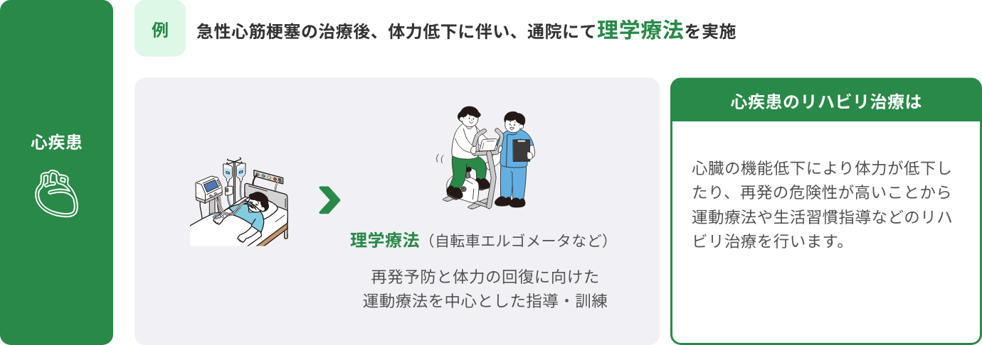 急性心筋梗塞の治療後、体力低下に伴い、通院にて理学療法を実施
