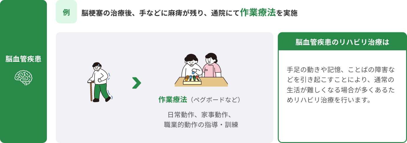 脳梗塞の治療後、手などに麻痺が残り、通院にて作業療法を実施