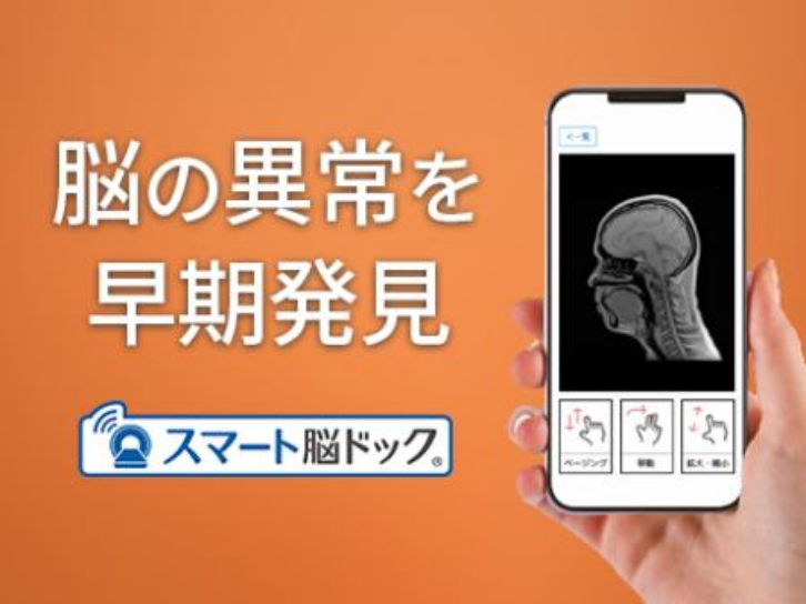 脳の異常を早期発見