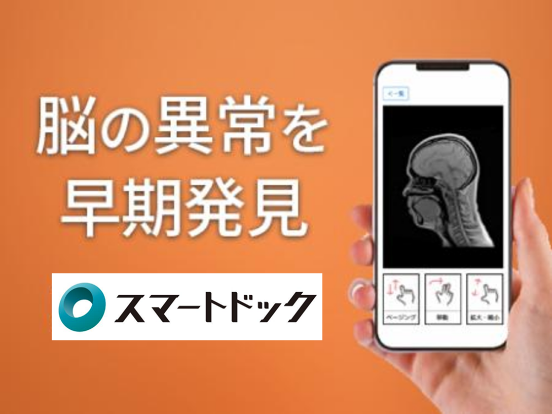 脳の異常を早期発見
